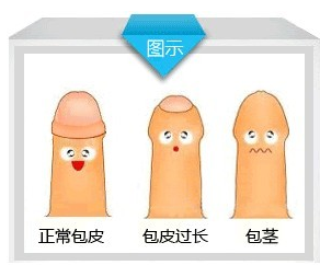 Ƥô