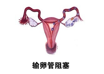 ѹ쳣